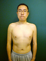 ダイエット後