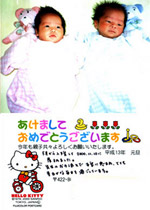 双子ちゃんを出産